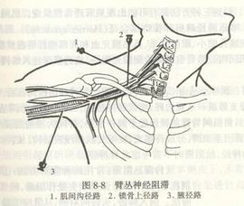 星状神经节阻滞