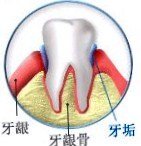 齿龈