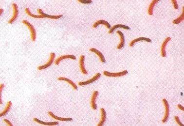 如霍乱弧菌.革兰氏染色阴性,长0.8~3μm,宽0.5~1.