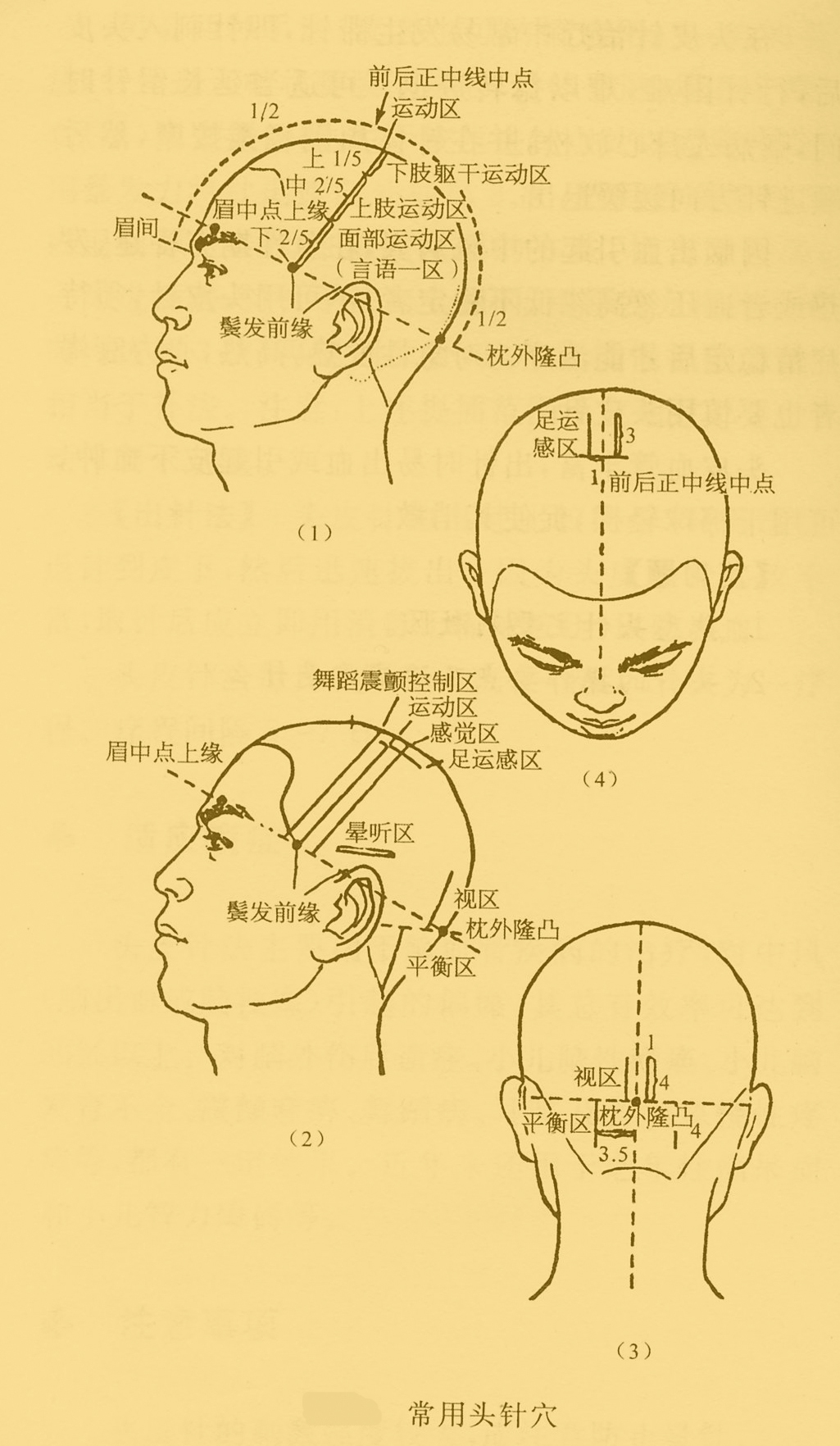 针法