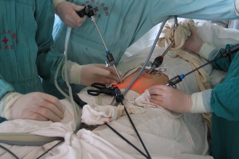 手術 腹腔 鏡