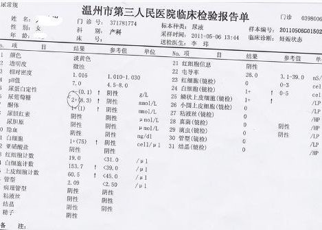 尿常规ph值 360百科