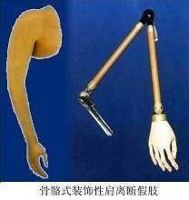 假肢定制行业迎来创新变革