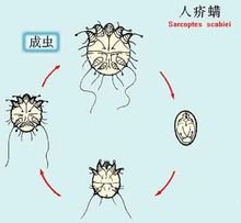 疥螨_360百科