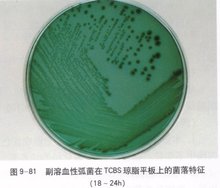弧菌属_360百科