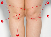 膝盖滑膜炎的走路视频 t01d051951332a5a43e.png