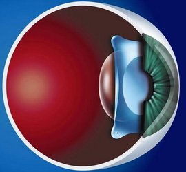 昆明眼科近视手术哪家医院好;近视手术应该怎么选;近视手术价格一览表 昆明眼科近视手术哪家医院好;近视手术应该怎么选;近视手术价格一览表