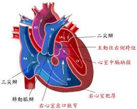 器质性心脏病