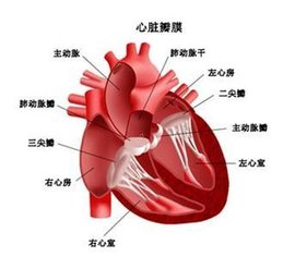 慢性风湿性心脏病