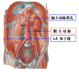 主动脉裂孔