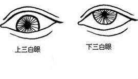 三白眼  免费编辑   添加义项名