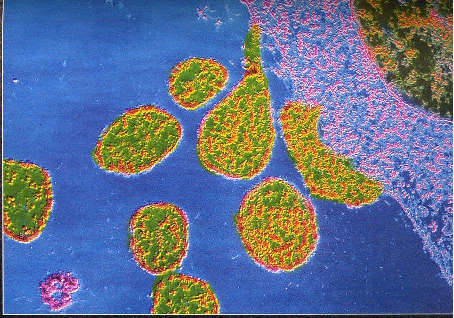 厌氧生物_360百科