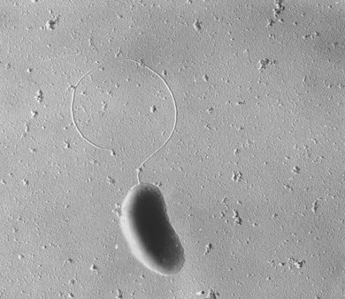 硫酸盐还原菌(石材)