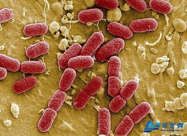 反硝化无色杆菌 (菌种)