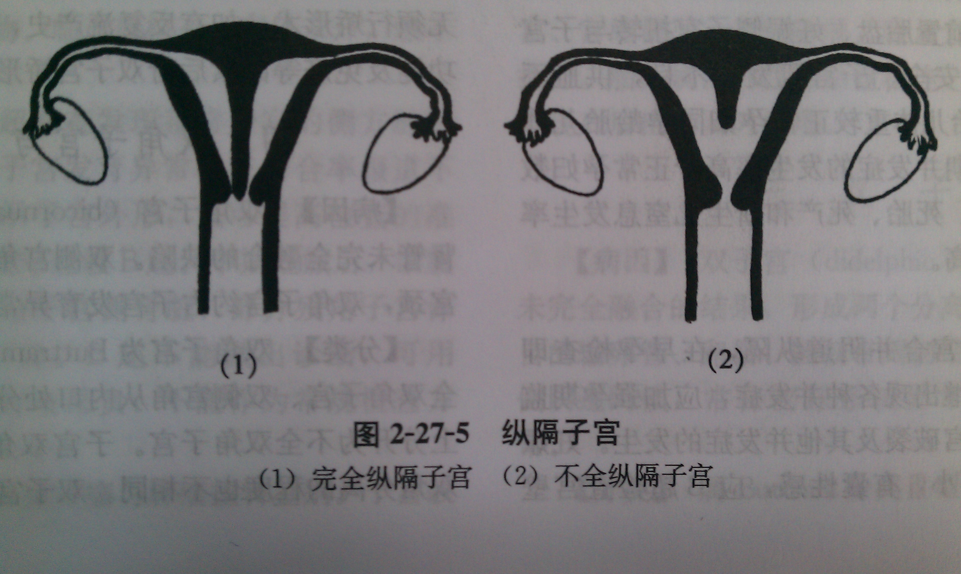 图2-6 子宫和输卵管的形态-妇产科学-医学