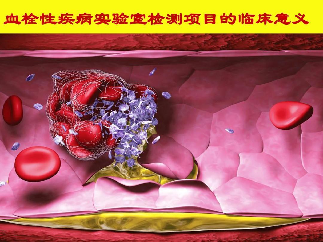 血栓图册_360百科