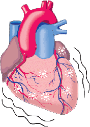 心室颤动(心血管病学 名词)