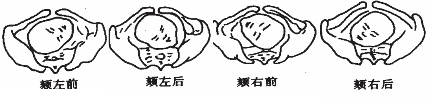 胎方位图册_360百科
