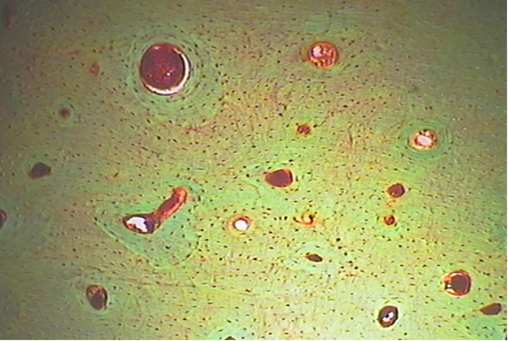 骨磨片显微镜图图片