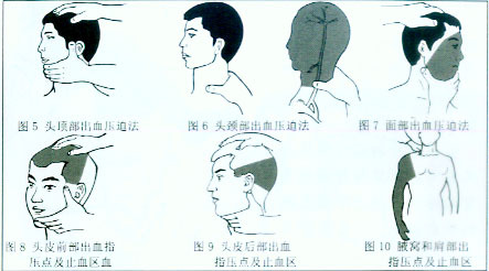快速止血法_360百科