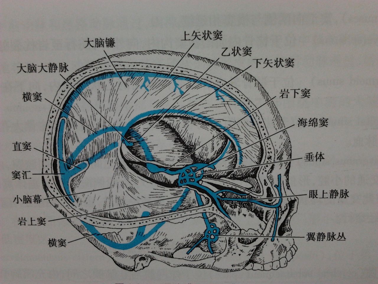 乙状窦解剖图图片