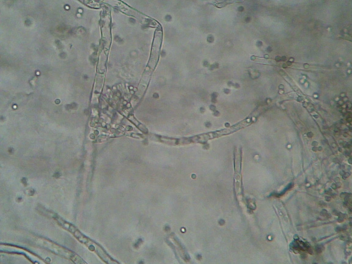 【显微镜】放线菌青霉毛霉根霉_哔哩哔哩_bilibili