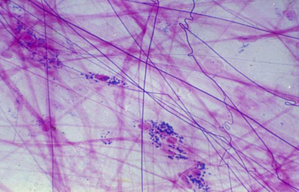 弹性纤维医药机械