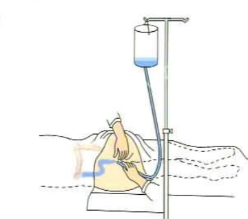 灌肠疗法(全科医学 名词)